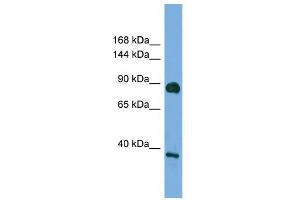 WB Suggested Anti-DLG4 Antibody Titration: 0. (DLG4 Antikörper  (Middle Region))