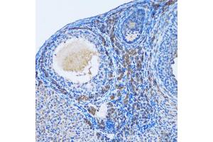 Immunohistochemistry of paraffin-embedded rat ovary using OGDH antibody (ABIN5973793) at dilution of 1/100 (20x lens). (alpha KGDHC Antikörper)