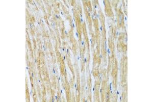 Immunohistochemistry of paraffin-embedded mouse heart using B antibody (ABIN7265851) at dilution of 1:100 (40x lens). (BAG3 Antikörper  (AA 380-575))