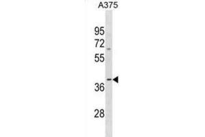 Western Blotting (WB) image for anti-Olfactory Receptor, Family 13, Subfamily D, Member 1 (OR13D1) antibody (ABIN3001031) (OR13D1 Antikörper)