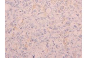IHC-P analysis of Human Ovary Tissue, with DAB staining. (CD5L Antikörper  (AA 133-256))