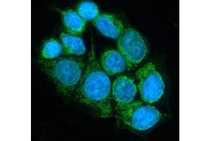 IF analysis of DLD using anti-DLD antibody (ABIN3043561). (DLD Antikörper  (AA 300-509))