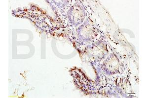 Formalin-fixed and paraffin embedded rat colon labeled with Rabbit Anti ERK1/MAPK3 Polyclonal Antibody, Unconjugated (ABIN736476) at 1:200 followed by conjugation to the secondary antibody and DAB staining (ERK1 Antikörper  (AA 101-200))