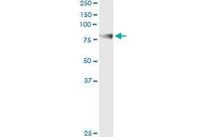 ENG (Human) IP-WB Antibody Pair