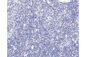Immunohistochemistry analysis of paraffin-embedded rat thymus using CCR5 Polyclonal Antibody at dilution of 1:300. (CCR5 Antikörper)