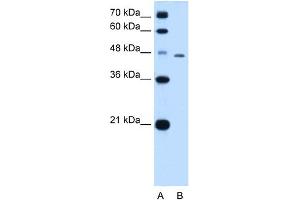 WB Suggested Anti-TAPBP Antibody Titration:  0.