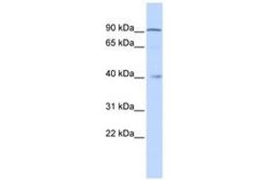 Image no. 1 for anti-Zinc Finger Protein 263 (ZNF263) (C-Term) antibody (ABIN6742791) (ZNF263 Antikörper  (C-Term))