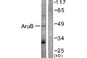 Immunohistochemistry analysis of paraffin-embedded human liver carcinoma tissue using AurB (Ab-12) antibody. (Aurora Kinase B Antikörper)