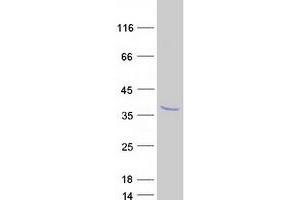 Western Blotting (WB) image for Calpain, Small Subunit 2 (CAPNS2) protein (Myc-DYKDDDDK Tag) (ABIN2713114)