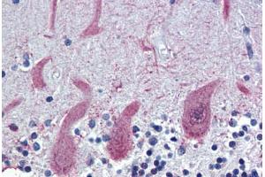 Human Brain, Cerebellum (formalin-fixed, paraffin-embedded) stained with ST18 antibody ABIN462193 followed by biotinylated goat anti-rabbit IgG secondary antibody ABIN481713, alkaline phosphatase-streptavidin and chromogen. (ST18 Antikörper  (AA 899-948))