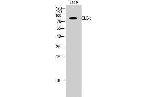 Western Blotting (WB) image for anti-Chloride Channel, Voltage-Sensitive 6 (CLCN6) (Internal Region) antibody (ABIN3174435) (CLCN6 Antikörper  (Internal Region))