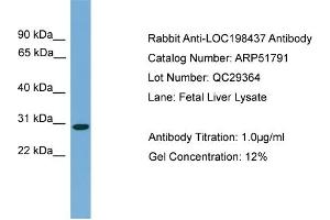 WB Suggested Anti-C20orf201  Antibody Titration: 0. (C20orf201 Antikörper  (C-Term))