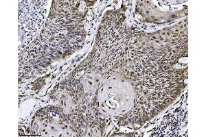 IHC analysis of NDFIP2 using anti-NDFIP2 antibody (ABIN7600173).