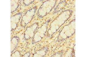 Immunohistochemistry of paraffin-embedded human colon tissue using ABIN7159692 at dilution of 1:100