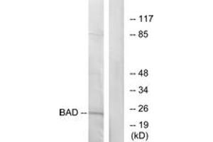 Western blot analysis of extracts from 293 cells, treated with Forskolin, using BAD (Ab-155) Antibody. (BAD Antikörper  (AA 119-168))