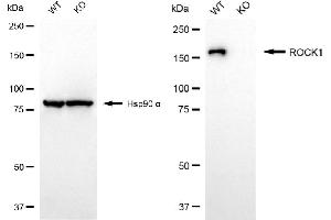 Western blotting analysis using ROCK1 antibody (ABIN7800204). (Rekombinanter ROCK1 Antikörper)