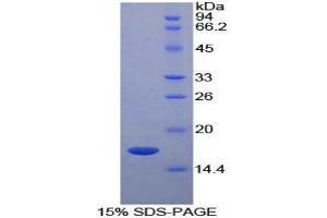 SDS-PAGE (SDS) image for Retinol Binding Protein 5, Cellular (RBP5) (AA 1-135) protein (His tag) (ABIN1080662)