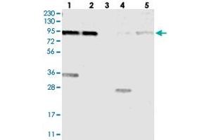 Western blot analysis of Lane 1: RT-4, Lane 2: U-251 MG, Lane 3: Human Plasma, Lane 4: Liver, Lane 5: Tonsil with KIAA1024 polyclonal antibody  at 1:250-1:500 dilution. (KIAA1024 Antikörper)