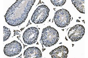 IHC analysis of XPD/ERCC2 using anti-XPD/ERCC2 antibody (ABIN7602458).