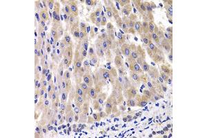 Immunohistochemistry of paraffin-embedded rat liver using RPL14 antibody. (RPL14 Antikörper)