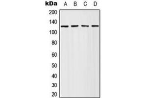 Western blot analysis of Adenylate Cyclase 4 expression in HeLa (A), Jurkat (B), SP2/0 (C), PC12 (D) whole cell lysates.
