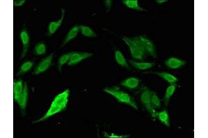 Immunofluorescent analysis of Hela cells using ABIN7170416 at dilution of 1:100 and Alexa Fluor 488-congugated AffiniPure Goat Anti-Rabbit IgG(H+L) (SP11 (AA 137-386) Antikörper)