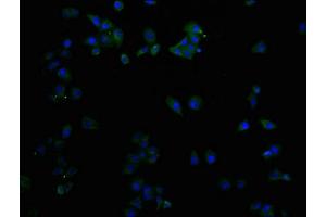 Immunofluorescence (IF) image for anti-CD9 (CD9) (AA 112-195) antibody (ABIN7147203)
