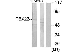 Western blot analysis of extracts from HUVEC cells and Jurkat cells, using TBX22 antibody. (T-Box 22 Antikörper  (N-Term))