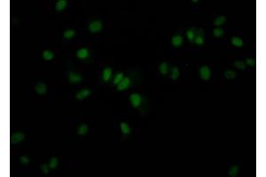 Immunofluorescence staining of MCF7 Cells with ABIN7127589 at 1:50, counter-stained with DAPI. (Rekombinanter JunB Antikörper)