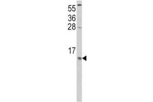 Western blot analysis of CCL2 antibody and HeLa lysate. (CCL2 Antikörper  (AA 62-89))