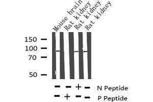 MAPT Antikörper  (pThr212)