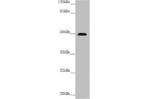 Western blot All lanes: PSTPIP1 antibody at 3. (PSTPIP1 Antikörper  (AA 157-416))