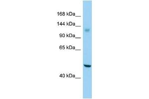 Host: Rabbit Target Name: GPR158 Sample Type: Jurkat Whole Cell lysates Antibody Dilution: 1. (GPR158 Antikörper  (C-Term))