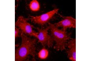 Immunofluorescence of human HeLa cells stained with monoclonal CLEC4E monoclonal antibody, clone AT16E3  (1 : 500) with Texas Red (Red). (CLEC4E Antikörper  (AA 41-219))