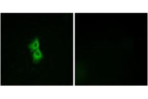 Immunofluorescence analysis of MCF7 cells, using GPR22 Antibody. (GPR22 Antikörper  (AA 271-320))