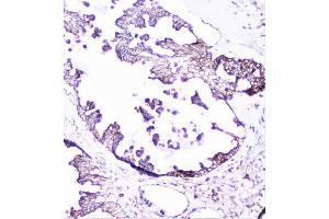 IHC analysis of cortactin using anti-cortactin antibody (ABIN6719306).