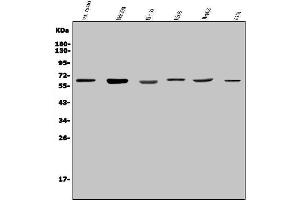 Western blot analysis of PARP2 using anti-PARP2 antibody (ABIN7599929).