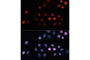 Immunofluorescence analysis of HeLa cells using TET1 Polyclonal Antibody (ABIN3022030, ABIN3022031, ABIN3022032, ABIN1513597 and ABIN6218576) at dilution of 1:100 (40x lens). (TET1 Antikörper)
