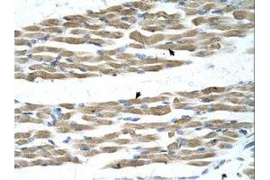 Image no. 2 for anti-Myc Proto-Oncogene protein (MYC) (N-Term) antibody (ABIN6737689)