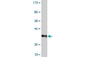 Western Blot detection against Immunogen (36. (LRRC2 Antikörper  (AA 272-371))