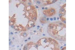 Used in DAB staining on fromalin fixed paraffin- embedded Kidney tissue (OCEL1 Antikörper  (AA 1-109))