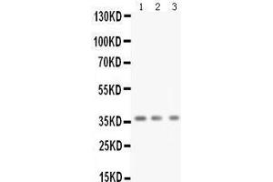 Anti-BDNF antibody, Western blotting All lanes: Anti BDNF  at 0. (BDNF Antikörper  (N-Term))