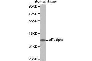 Western Blotting (WB) image for anti-Eukaryotic Translation Initiation Factor 2 Subunit 1 (EIF2S1) antibody (ABIN2650910) (EIF2S1 Antikörper)