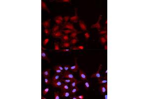 Immunofluorescence analysis of MCF-7 cells using Phospho-ABL1-Y245 antibody (ABIN5969865). (ABL1 Antikörper  (pTyr245))