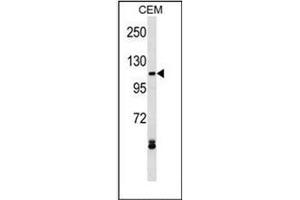 Western blot analysis of EVI1 Antibody (N-term) in CEM cell line lysates (35ug/lane).