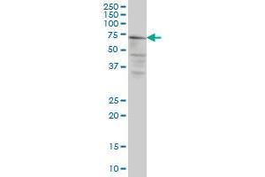 CAPN5 monoclonal antibody (M02A), clone 3C10 Western Blot analysis of CAPN5 expression in HeLa . (Calpain 5 Antikörper  (AA 523-622))