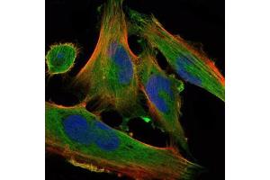 Immunofluorescence analysis of U251 cells using DLK1 mouse mAb (green).