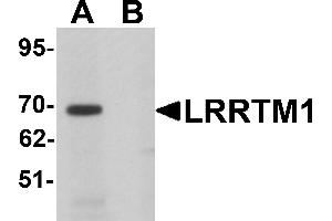 Western Blotting (WB) image for anti-Leucine Rich Repeat Transmembrane Neuronal 1 (LRRTM1) (C-Term) antibody (ABIN1030496) (LRRTM1 Antikörper  (C-Term))