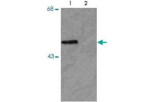 Western blot of HEK293 cells transfected with PARK2 WT (Phospho) and PARK2 S378 mutant (non-phospho) showing the phospho-specific immunolabeling of the ~ 52 k parkin protein. (Parkin Antikörper  (pSer378))