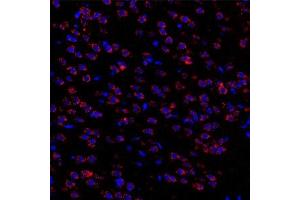 Immunofluorescent analysis of paraformaldehyde-fixed rat brain nigra using Torsin A (ABIN7075942) at dilution of 1: 3000 (TOR1A Antikörper)
